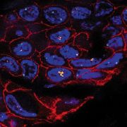 fluorescence_her2-centromere_axiocam-mrm.if.jpg