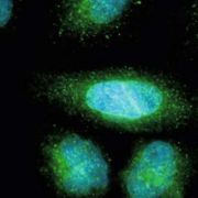fluorescence_hela-cells_axio-imager-2.jpg